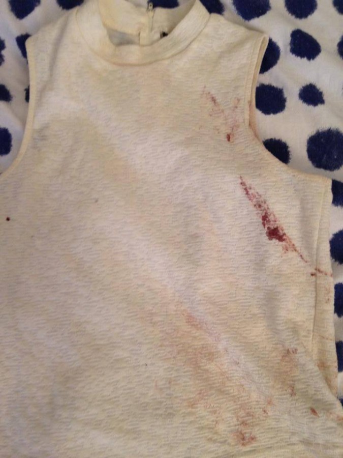 Shirt with blood