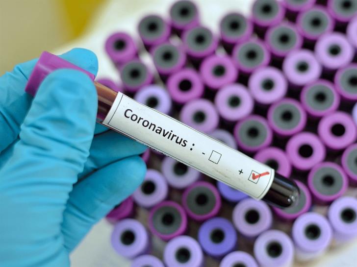 Coronavirus Blood Test South Africa