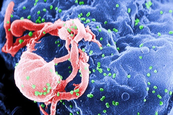 The image is an electron micrograph of HIV (coloured in green) budding from a lymphocyte. Taken by C. Goldsmith for the CDC, via Wikipedia.