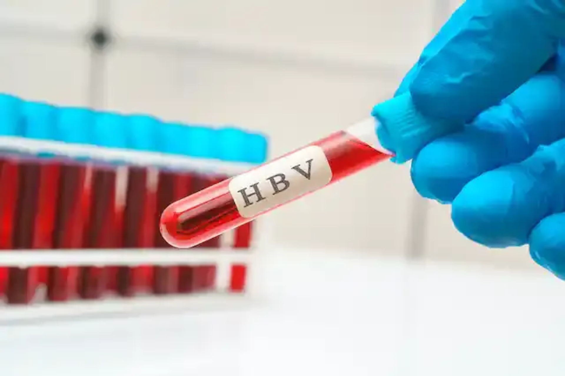 Hepatitis B early detection