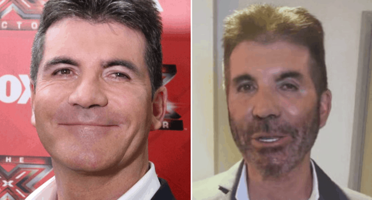 Fans react to Simon Cowell’s new face