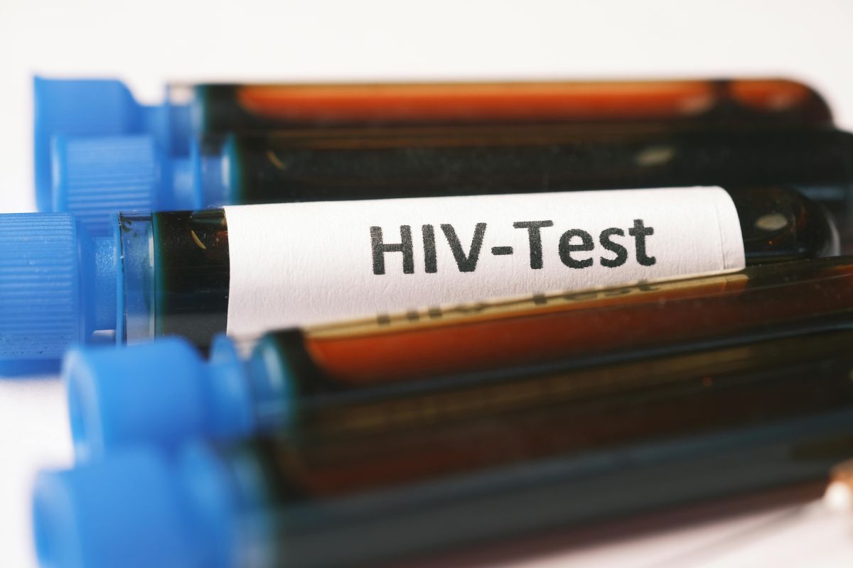 Drop of HIV in Uganda